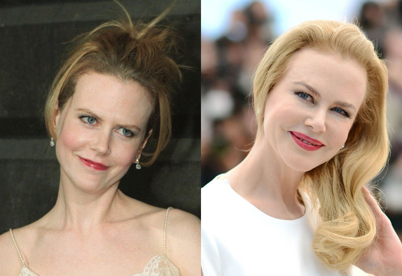 nicole kidman