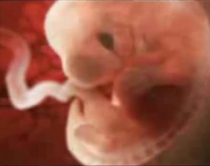 Qelizat e kordonit të bebit <br />mrekullia që shëron 80 sëmundje