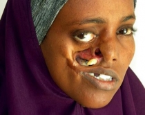 23 vjet e shp&euml;rfytyruar,<br />m&euml; n&euml; fund do t&euml; operohet