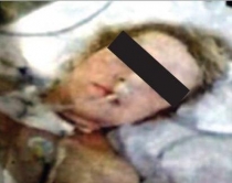 Studentja futet në koma, merr<br />infeksion të rëndë në QSUT