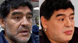 Maradona bën operacion<br />plastik për tu dukur më i ri
