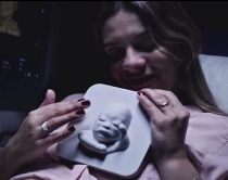 Surprizë për nënën shtatzënë të verbër, <br />eko 3D për të dalluar tiparet e foshnjes 
