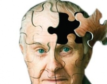 Si duhet të trajtohen të moshuarit <br /> me sëmundjen e Alzheimerit