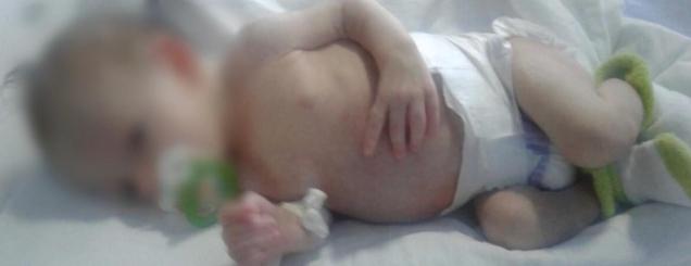 Bebja 2 javëshe me fibroze ciste<br />babai: Nuk mund të kurohet këtu 