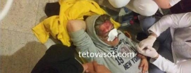 Pamje t&euml; reja t&euml; Ziadin Sel&euml;s<br />i p&euml;rgjakur nga huligan&euml;t/FOTO