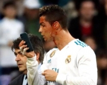 Kristiano Ronaldo goditet në fushë<br />merr celularin për të parë plagën<br>
