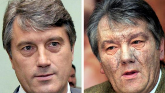 Viktor Yushchenko për helmim: Gruaja ime tha buzët e tua kanë shije metalike/VD
