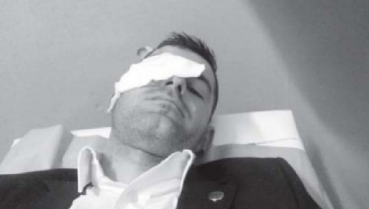 Dhuna/ Gjyqtari i ndeshjes në Vlorë me tre të qepura në vetull: Isha i hutuar, dikush më goditi 