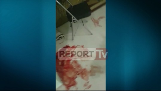 Dibër/ Grabitje me armë, djali përleshet me hajdutin, merr 3 plumba