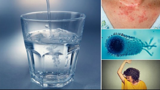 Konsumoni pak ujë gjatë ditës,  ja pesë dëmtimet që i shkaktoni organizmit tuaj