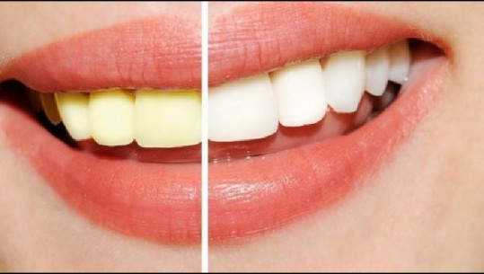 Zbuloni mënyrën më të shpejt për zbardhjen e dhëmbëve, madje dhe pa shkuar tek dentisti