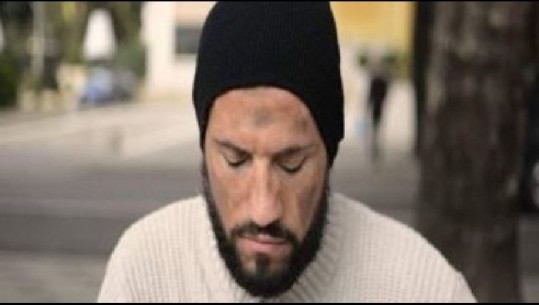Këngëtari shqiptar maskohet si lypës, shtanget nga reagimet e qytetarëve të Tiranës