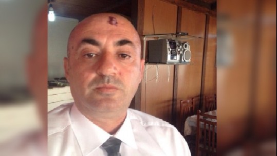 Urdhëroi prishjen e një ndërtese, kërcënohet me jetë nga katër persona kreu i IMT-së Durrës, Ardian Halili 
