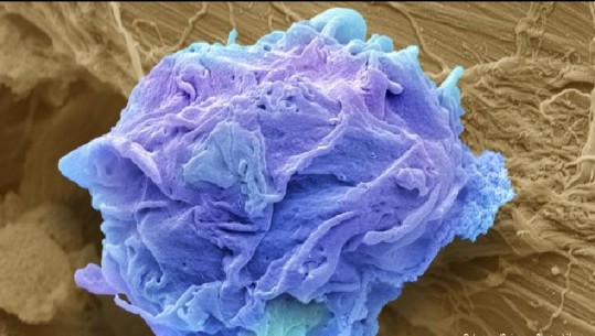Shkencëtarët gjermanë zbulojnë substancën që vret qelizat e kancerit