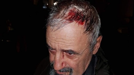Plagoset në protestë fotografi, shfaqet i gjakosur në kokë
