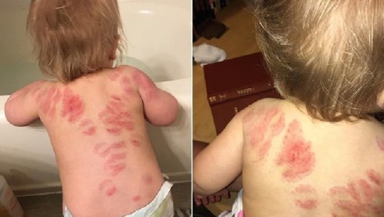 Kthehet me 25 kafshime nga çerdhja, nëna e tmerruar me gjendjen e së bijës (FOTO)