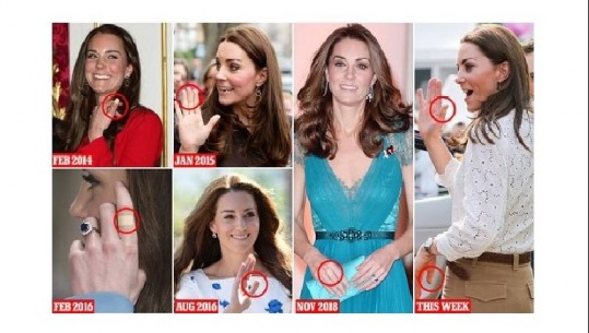Çfarë ndodh me Kate Middleton? Gjithmonë del në publik e fashuar (FOTO)