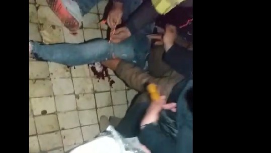 Protesta shkon keq! Militantët plagosin me mjete shpërthyese njërin nga simpatizantët (VIDEO)