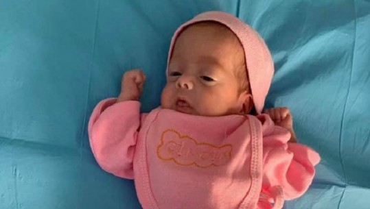 Ndodh mrekullia me foshnjen në Durrës, lindi vetëm...800 gr (FOTOT)