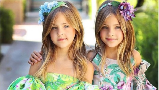 Njihuni me binjaket më të bukura në botë (Foto)