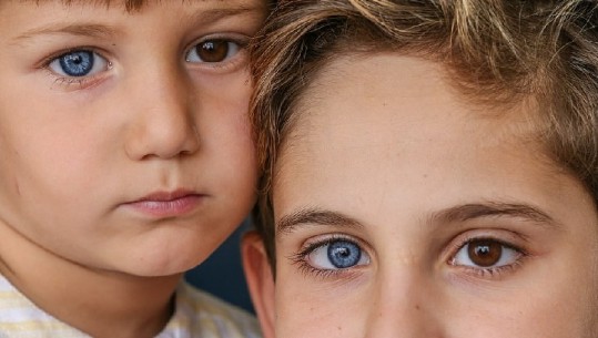 Njihuni me  vëllezërit turq që kanë njërin sy kaf dhe tjetrin të kaltër (FOTO)
