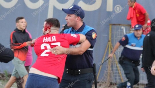 'Përgjaket' derbi, tifozët e Tiranës dhe Partizanit zihen dhe përleshen në stadium (FOTO)