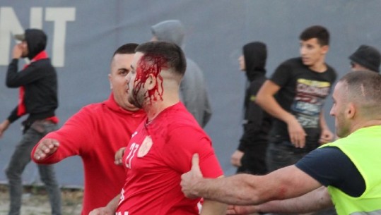 Përgjaket derbi, disa të lënduar nga përleshja mes tifozëve! Partizani fiton ndaj Tiranës 2-1 (VIDEO)