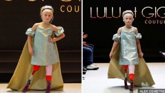 9-vjeçarja me këmbë të prera shkëlqen në Javën e Modës në Paris