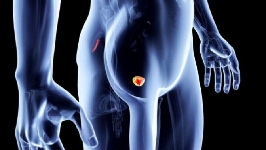 Konsumimi i kërpudhave ul rrezikun e kancerit të prostatës