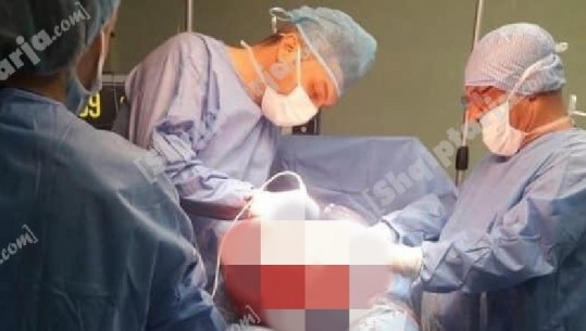 Ndërhyrje e rrallë në spitalin e Elbasanit/ Dy mjekët operojnë 12 kg 'mish të huaj' nga barku i një pacienteje