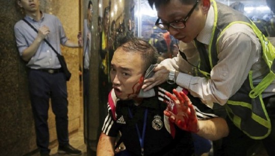 Hong Kong/ Agresori i këput veshin politikanit, 5 të plagosur nga sulmi në qendrën tregtare (VIDEO)