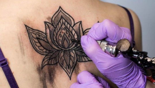 Ekspertët e Dermatologjisë: Gjilpëra e tatuazhit ‘shkarkon’ në trupin e njeriut metale të rënda