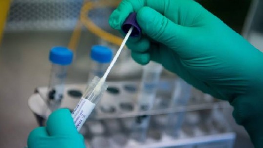  Kura kundër koronavirusit, CDC bën hapin e parë për tejkalimin e situatës kritike/ FDA: Laboratorët e tjerë të përdorin testin e zhvilluar të CDC