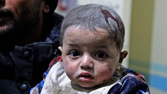 PAMJE TË RËNDA! Fëmijët, viktima të luftës në Siri, forcat e Asad bombardojnë civilë