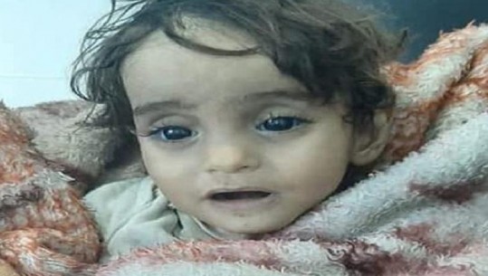 Kriza në Siri, Iman, një vjeçe e gjysmë vdiq nga i ftohti: Historia e një katastrofe humanitare