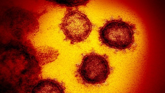 Një virus vdekjeprurës që po përhapet me shpejtësi, a është koronavirusi një pandemi? Çfarë është një pandemi? Ja çfarë thotë shkenca