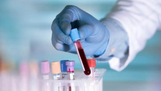 Kinezët zbulojnë cili grup gjaku është më i ekspozuar ndaj koronavirusit: Kjo nuk do të thotë të mos lani duart