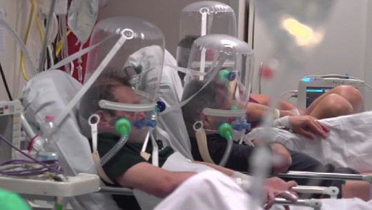 Pamje të rënda/ Spitali i mbingarkuar i Bergamos në gjendje kaosi, mjekët luftojnë dëshpërimisht me virusin, helmeta ajri pacientëve në terapi intensive  