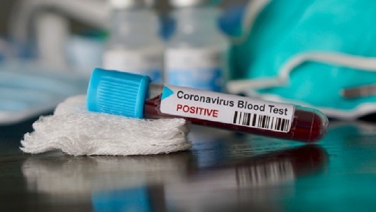 OBSH publikon FAKTET e reja në lidhje me koronavirusin