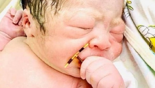 'Jeta është e fuqishme', foto hit në internet! Foshnja lind me kontraceptivin e nënës në dorë