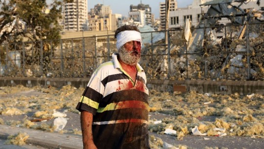 Autoritetet thirrje spitaleve për mobilizim pas qindra të plagosurve prej shpërthimit në Bejrut