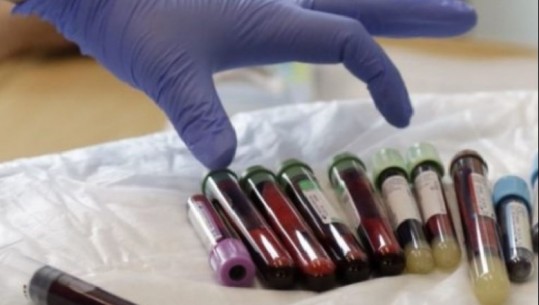 Zbulimi italian për kurimin e kancerit: Proteinë që riparon ADN-në