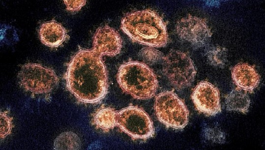 25 vjeçari amerikan riinfektohet me COVID-19, hera e dytë e infektimit ishte me simptoma më të rënda 