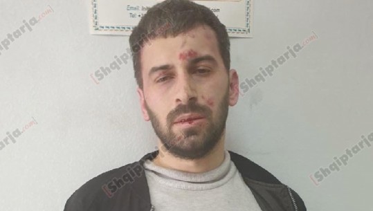 Sulmi me thikë në xhaminë te Rruga e Kavajës, kush është Rudolf Nikollaj, i cili plagosi 5 persona