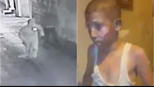 Sulmohet me molotov shtëpia në Gaza, 12 vjeçari në gjendje të rëndë! Jeta e të miturit në rrezik nga djegiet e shumta! (VIDEO)