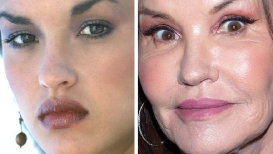 10 fotografi që tregojnë se si kanë ndryshuar fytyrat e modeleve të njohura me kalimin e kohës