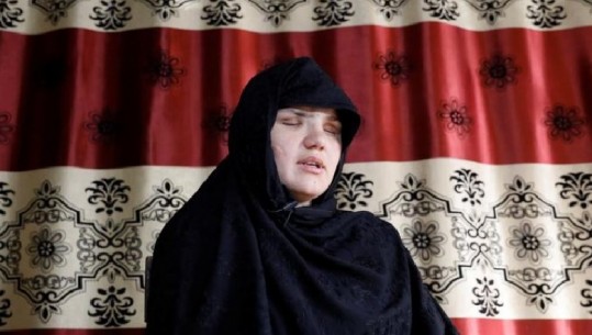 Talebanët i nxjerrin sytë se donte të punonte, rrëfimi tronditës i 33-vjeçares: Qentë do ushqehen nga mishi i grave në Afganistan