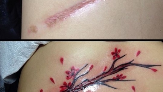10 herë kur artistët e tatuazheve i shndërruan plagët në vepra arti