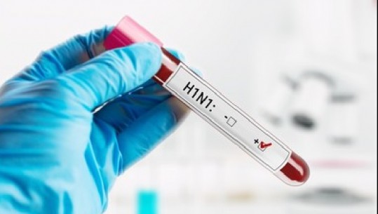 Konfirmohet prania e gripit në Shqipëri, zbulohen dy raste që i përkasin virusit të tipit A
