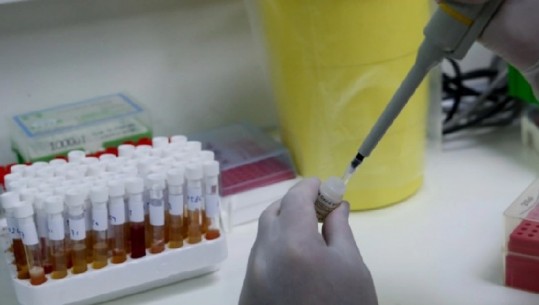 Identifikohet një variant i ri i koronavirusit në Qipro, 25 persona të infektuar
